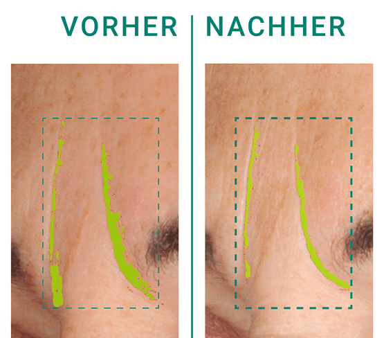 Dermokosmetische Wirkstoffe