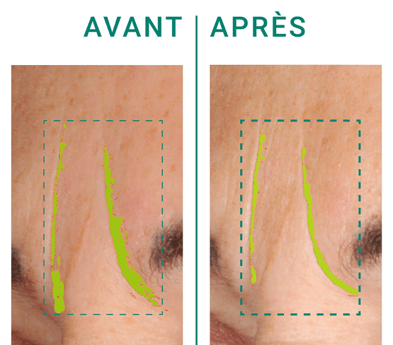 Actif dermocosmétique