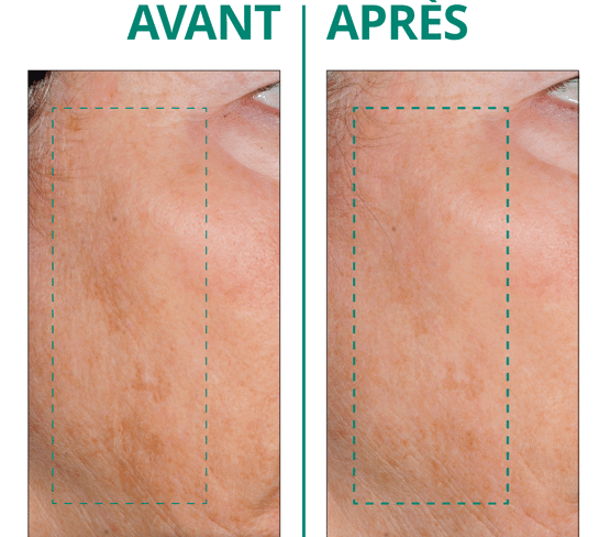 Actif dermocosmétique