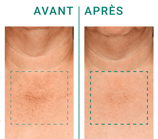 Actif dermocosmétique