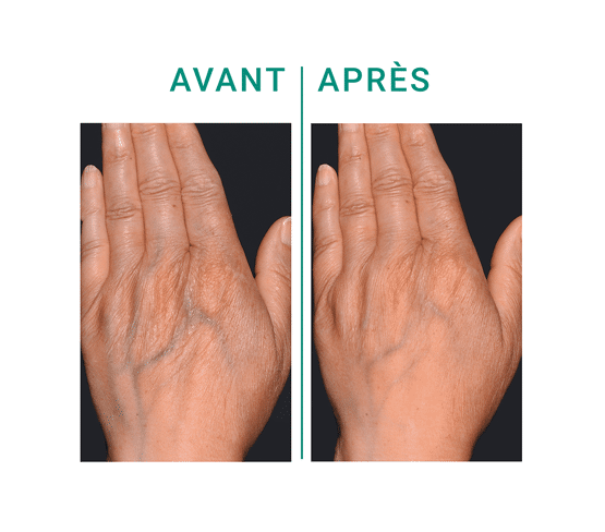 Crème mains hydratante, repulpante et embellissante